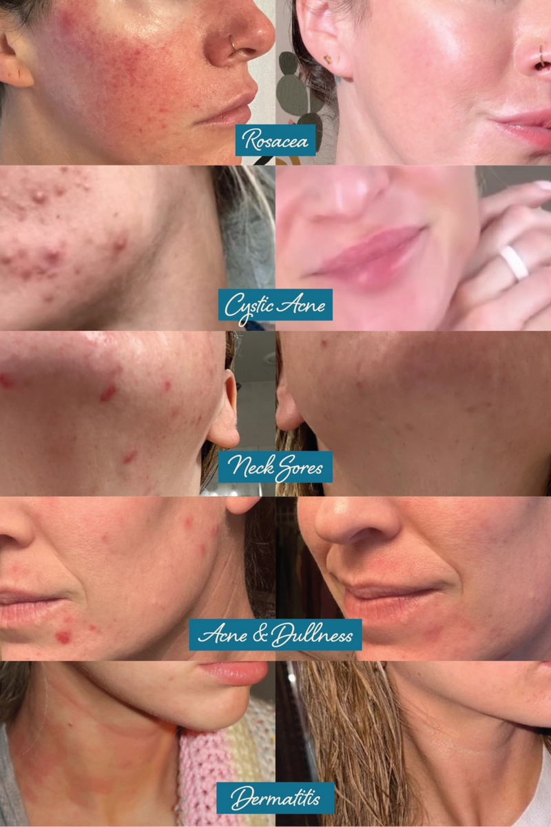 Tallow + Tansy Face Balm